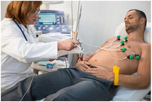 ECG